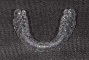 Removable retainers Removable retainers