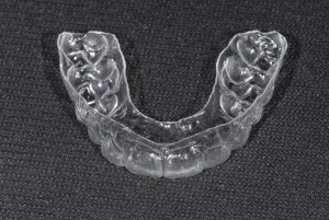 Removable retainers