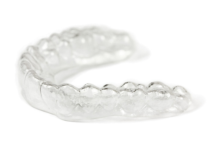 Clear Aligners